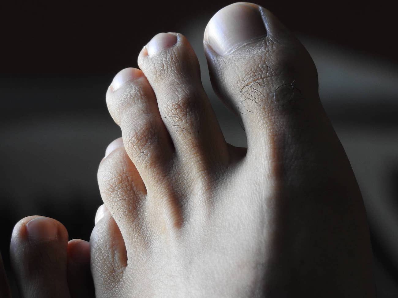 Callus-free feet, footcare