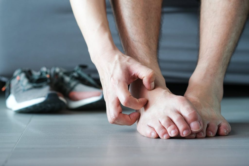 Rash 101 The Most Common Types of Foot Rashes