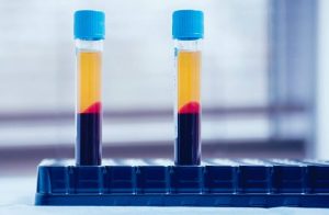 Platelet-Rich Plasma injection therapy