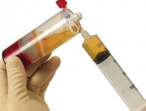Regenerative Injection Therapy & Bone Marrow Aspirate Concentrate Injections