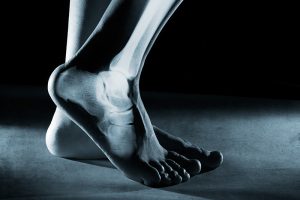 Benefits of Minimally Invasive Foot and Ankle Surgery