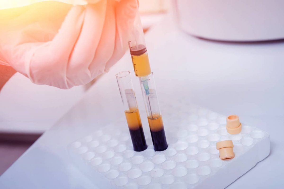Platelet Rich Plasma for Heel Pain