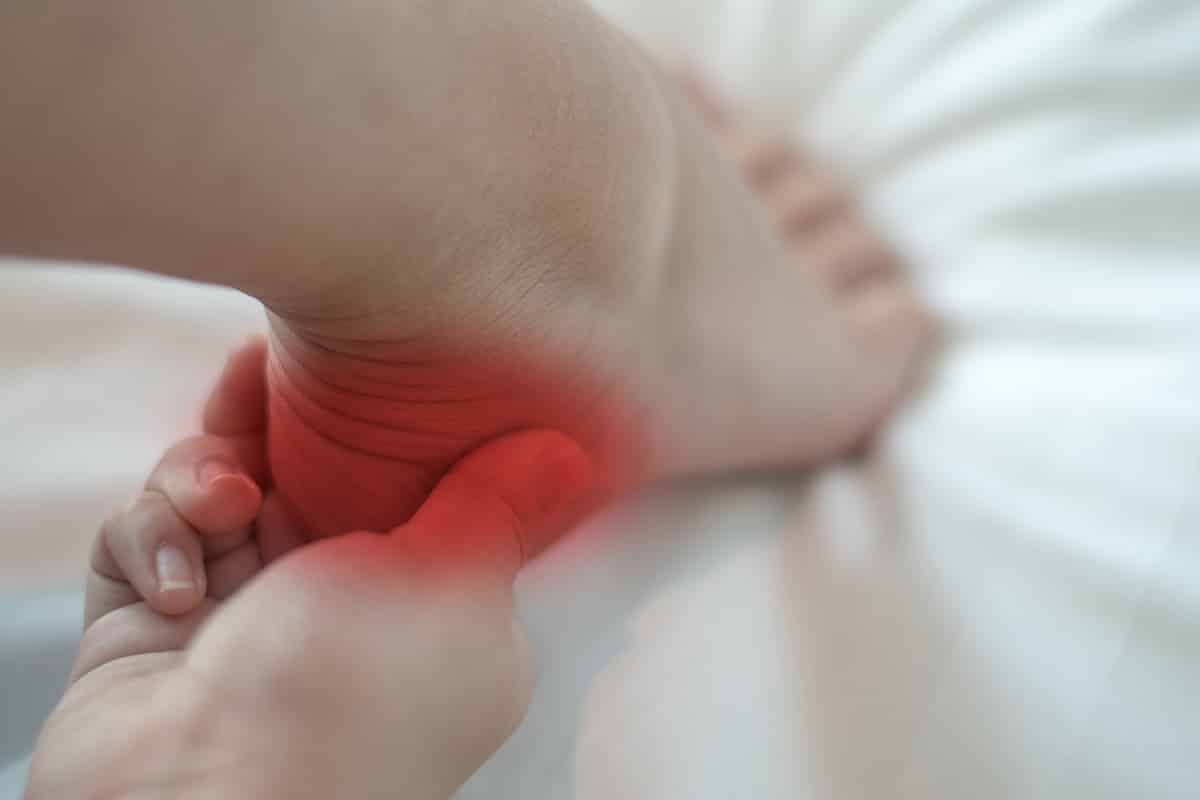 Heel Spurs What Cause Them and How Do You Treat Them