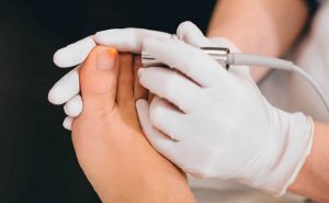 Laser Treatment Toenail Fungus