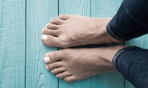 Bunion Removal Surgery